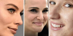 پوست طبیعی و بینی قوزدار ترند شدند! زیبایی دور از دسترس دیگر مد نیست