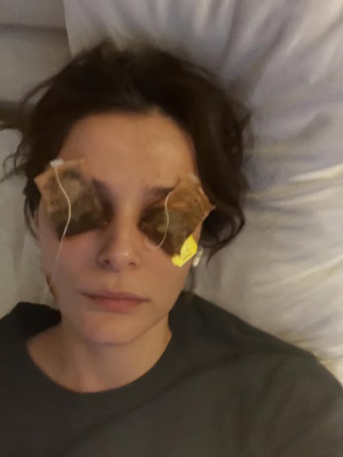 رفع پف چشم به شیوه بازیگر ترک