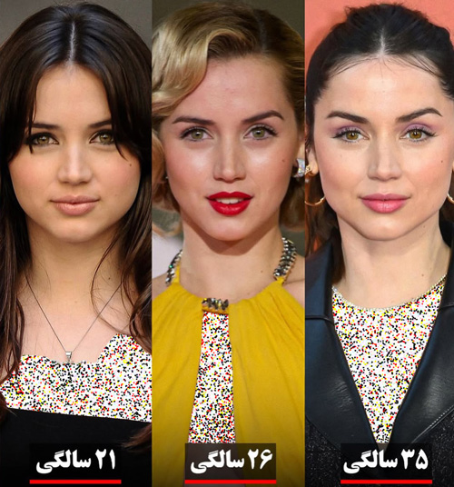 تغییر چهره آنا د آرماس