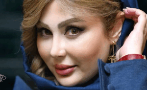 نیوشا ضیغمی در سال ۱۳۸۵؛ عکس‌هایی از قبل از جراحی‌های زیبایی