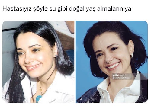 چروک صورت بازیگر ترک