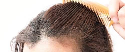 ماینوکسیدیل چیست؟