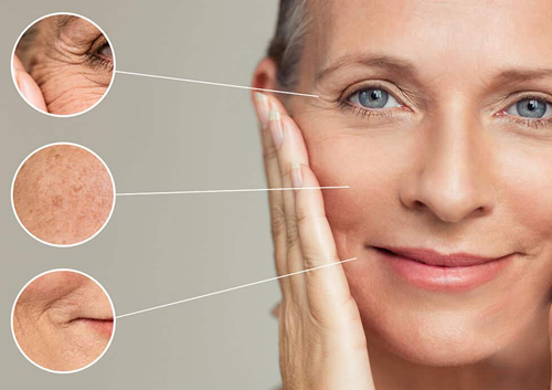 جوانسازی پوست با جیسل؛ نسل جدید جوانسازی بازساختی بدون درد و نقاهت