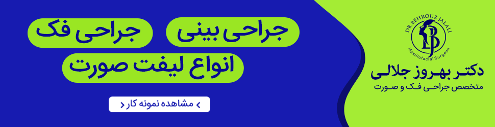 single_end ad banner