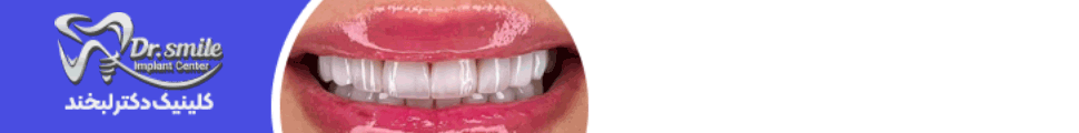 single_down2 ad banner