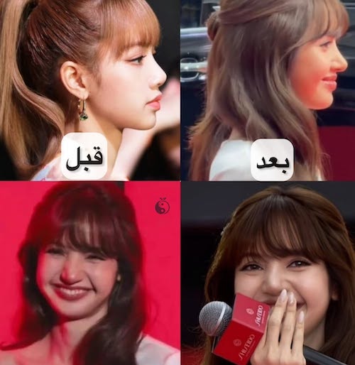تغییر فرم بینی لیسا