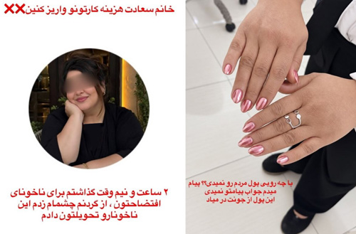 فرار بعد از کاشت ناخن