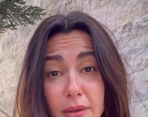 چهره بدون بوتاکس نسرین