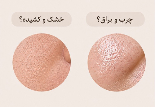 نوع منافذ پوست