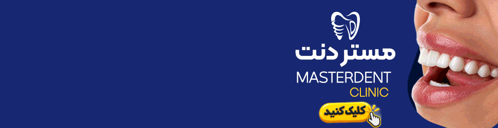 single_end ad banner